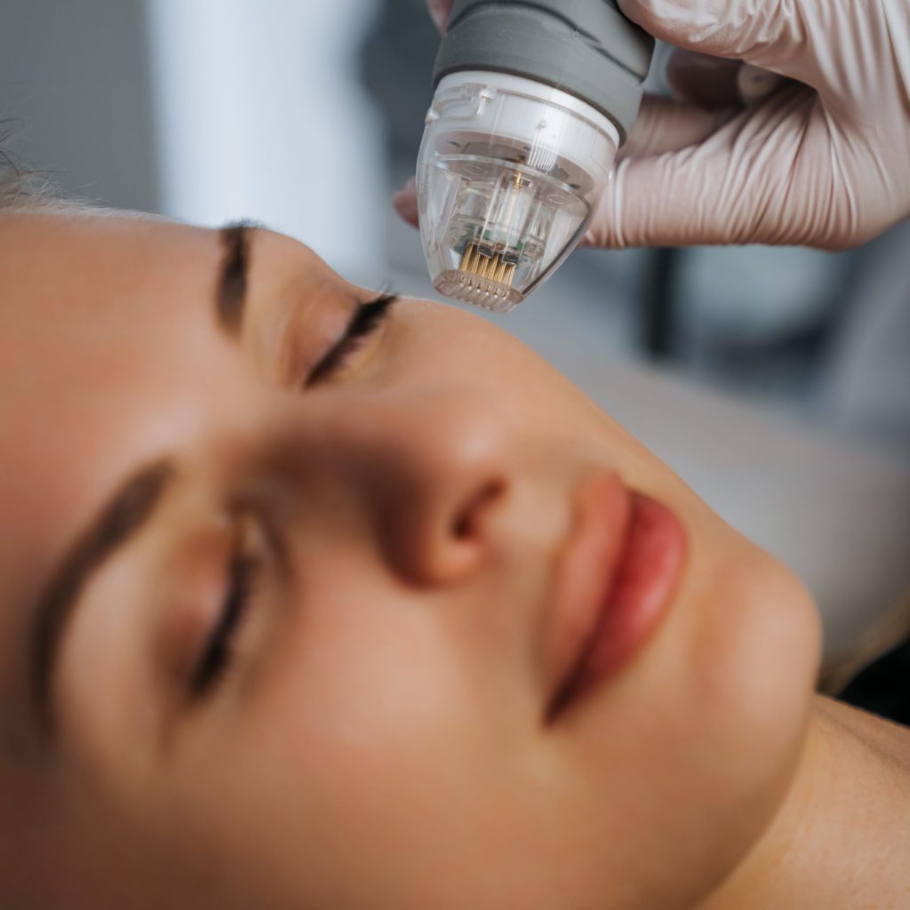 Microneedle RF lifting in a beauty salon. Big plan. High quality photo