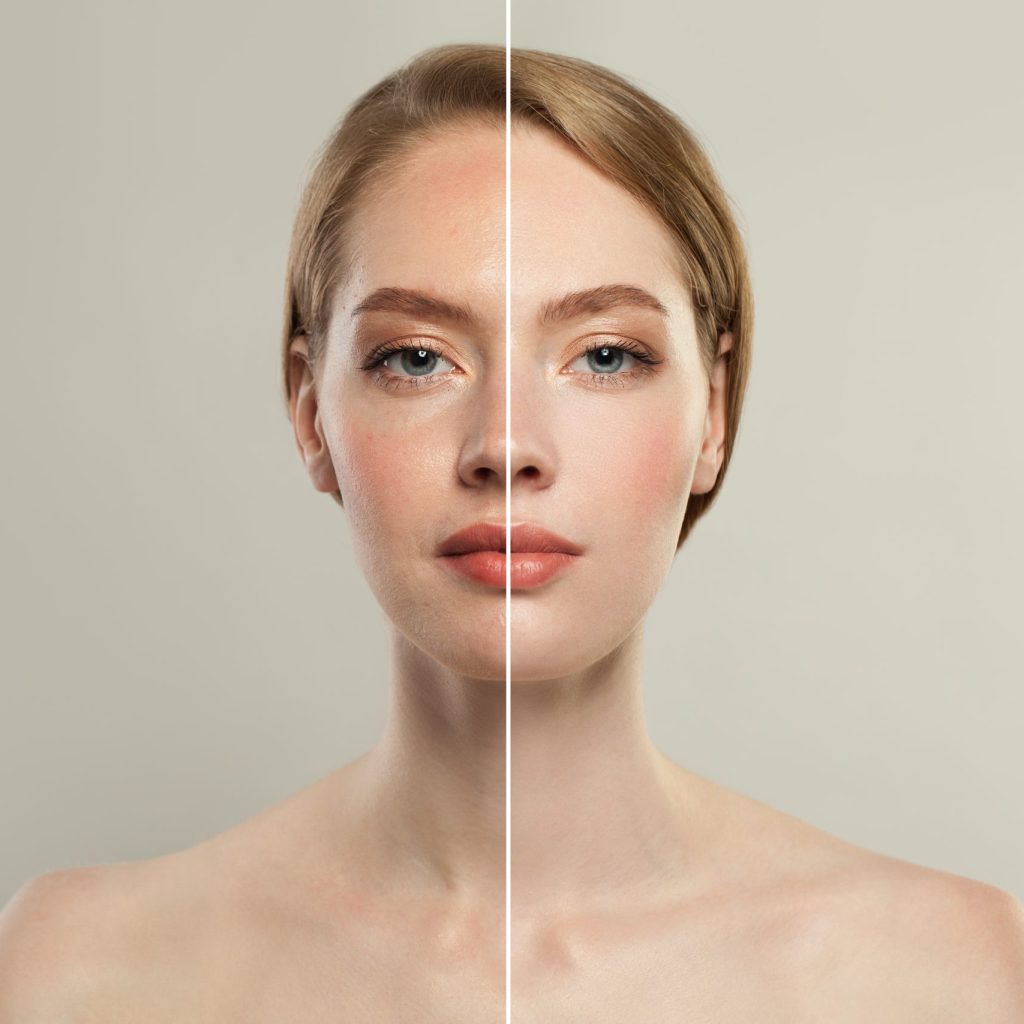 Young model woman face with retouching and without retouching. Female skin with make up and without makeup. Make up, Facial Treatment and Skincare Concept